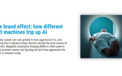 The brand effect: how different MRI machines trip up AI